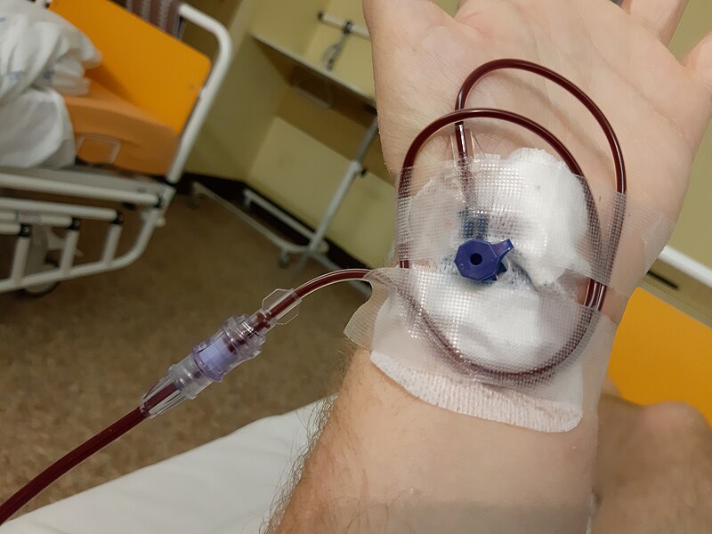 Transfusión de sangre